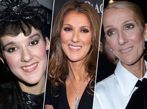 celine dion chirurgie esthétique|Céline Dion se dit prête à faire appel à la chirurgie .